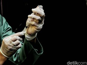 Cerita Non Nakes Dapat Vaksin Moderna, Terpilih Random atau Prioritas?