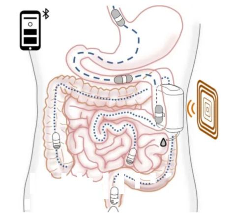 Robot insulin