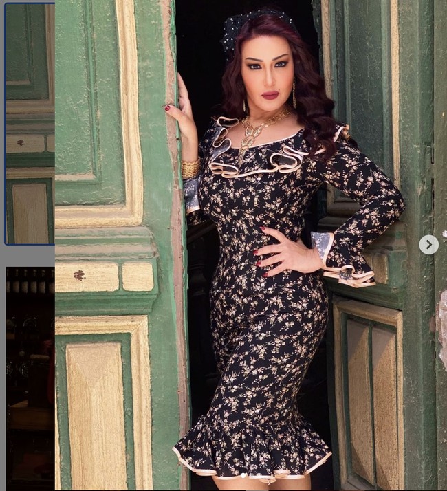 Somaya El-Khashab mengaku kerap dipukul Ahmed dan pernah masuk rumah sakit karena aksi kekerasan penyanyi terkenal di Mesir itu. Dia juga membantah tudingan mengeruk uang Ahmed Saad. Somaya mengaku justru selama pernikahannya dengan Ahmed, dia merasa hidup dalam bahaya. Foto: Instagram