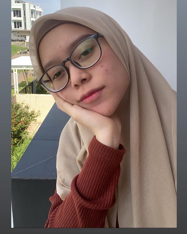 Ketika posting foto tanpa makeup di Instagram, penampilannya dianggap apa adanya. Foto: Instagram