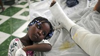 Younaika, salah satunya, anak Jertha Ylet itu kini tinggal sementara di rumah sakit sembari menemani sang ibu mendapat perawatan dari tim medis usai gempa berkekuatan M 7,2 menghancurkan rumah mereka. AP Photo/Matias Delacroix.