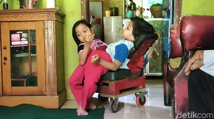 Bocah kembar siam dempet perut asal Garut ini divonis sejak lahir tak bisa dipisah. Sempat jalani operasi-perawatan di RSHS Bandung, bagaimana kabarnya kini?