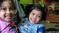 Meskipun divonis tak bisa dipisah sejak lahir, mereka tetap semangat menjalani hidup. Dewi dan Putri yang kini berusia 7 tahun itu pada tahun 2017 lalu sempat menjalani operasi penghilangan kaki tambahan di RS Hasan Sadikin, Bandung. Operasi sukses dilakukan tim dokter.