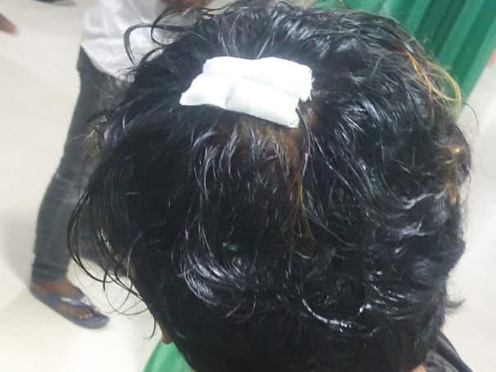 Pria di Bulukumba, Sulsel ngaku dianiaya polisi hingga ditodong laras panjang, Saenal (20). (dok. Istimewa)