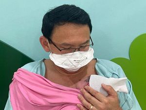 Ahok Unggah Foto Wajah Putrinya, Sarah Eliana Purnama
