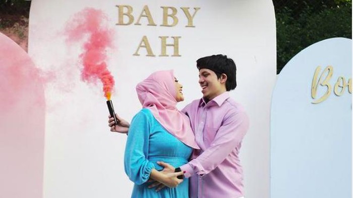Aurel Hermansyah hamil anak perempuan