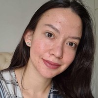 Puteri Indonesia Pariwisata 2017 Karina Nadila juga pernah menampilkan wajahnya dengan jerawat. Dia mengaku sejak masa puber menjadi pejuang jerawat. Foto: Instagram