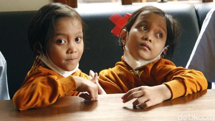 Al Dewi Putri Ningsih (8) dan Al Putri Anugrah (8) merupakan bocah kembar siam dempet perut asal Wanaraha, Garut. Keduanya giat belajar dan tekun menghafal Alquran.