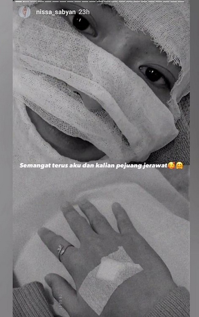 Yang terbaru ada Nissa Sabyan yang wajahnya sampai diperban. Dalam keterangan fotonya di Instagram, Nissa mengatakan bahwa dia adalah pejuang jerawat. Foto: dok. Instagram/@nissa_sabyan