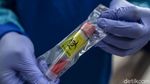 Puskesmas Jemput Bola Tes Swab COVID-19