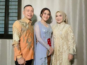 Anti Mainstream, Ibu Ayu Ting Ting Pakai Strap Mask Dari Emas Asli