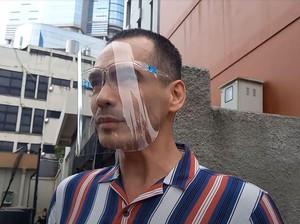 Atalarik Syah Dibully Gegara Kepala Plontos