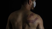 Wartawan Afghanistan ditahan dan dipukuli oleh pasukan Taliban setelah meliput aksi protes perembuan di Kabul.