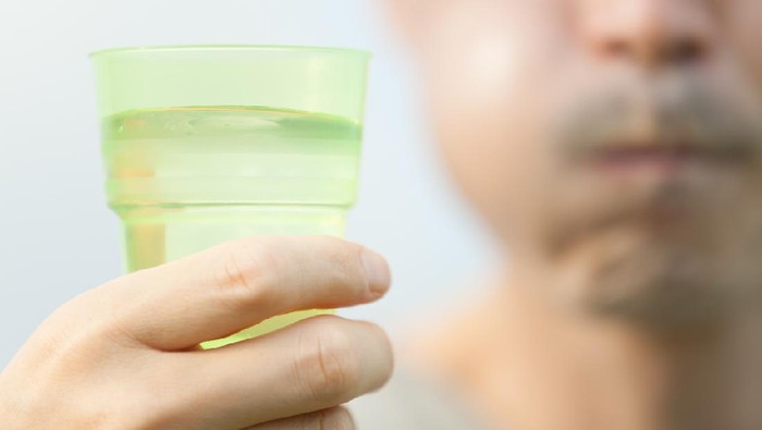 Sunnah Rasulullah SAW untuk Berkumur Usai Minum Susu