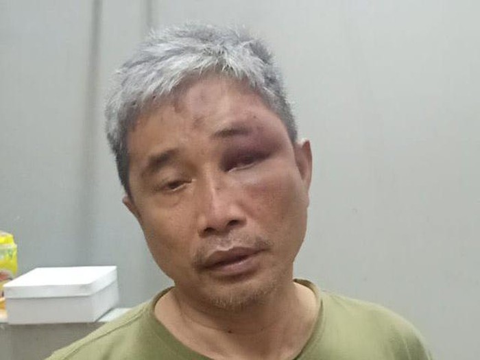 Foto Muhammad Kace Usai Dianiaya Irjen Napoleon BonaparteD