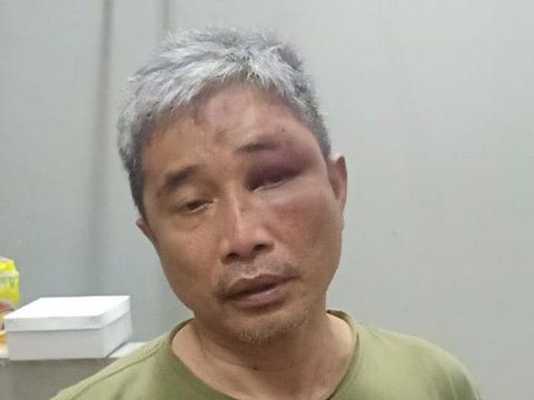 Foto Muhammad Kace Usai Dianiaya Irjen Napoleon BonaparteD