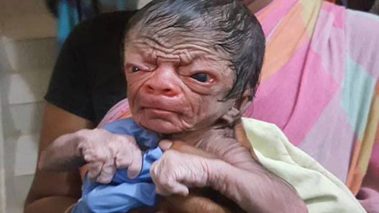 Bayi viral berwajah tak biasa