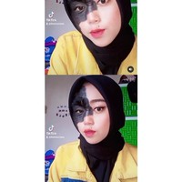 Remaja berhijab itu menuturkan jika sudah terbiasa dan menerima kondisi wajahnya. Ika tak merasa sedih ia malah tampil percaya diri dengan membuat video cover TikTok dan berfoto OOTD di akun media sosialnya. Sudah biasa aja gitu. Aku suka aja bermain TikTok. Aku sudah berdamai dengan diri sendiri, jelasnya. Foto: Dok.Instagram @ikamasriana.