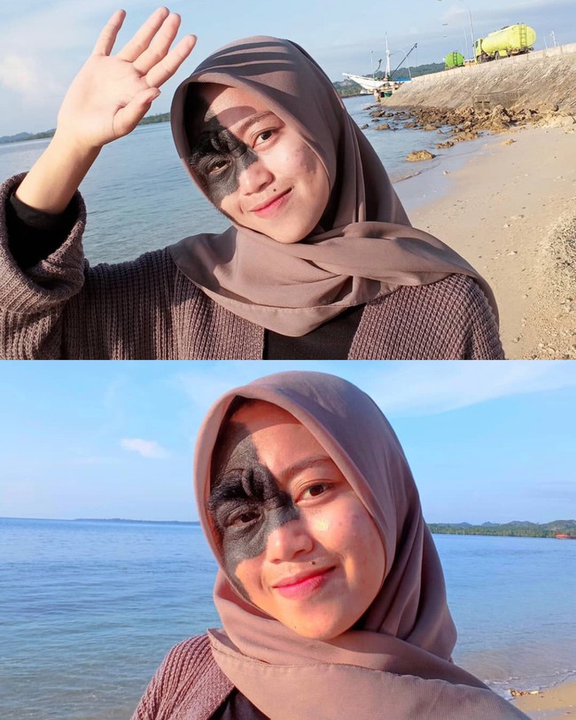 Memiliki tanda lahir ukuran besar di wajahnya, Ika mengaku tidak merasakan apapun. Dia merasa seperti memiliki kulit wajah biasa. a pun merasa lebih percaya diri usai membuat video di TikTok. Karena bisa memberikan inspirasi dan mendapatkan dukungan dari warganet. Iya aku senang karena bisa memberikan inspirasi bagi orang-orang. Warganet banyak mengucapkan terimakasih kepada aku, terangnya. Foto: Dok.Instagram @ikamasriana.