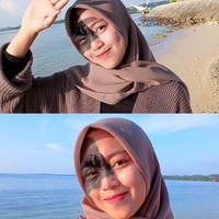 Memiliki tanda lahir ukuran besar di wajahnya, Ika mengaku tidak merasakan apapun. Dia merasa seperti memiliki kulit wajah biasa. a pun merasa lebih percaya diri usai membuat video di TikTok. Karena bisa memberikan inspirasi dan mendapatkan dukungan dari warganet. Iya aku senang karena bisa memberikan inspirasi bagi orang-orang. Warganet banyak mengucapkan terimakasih kepada aku, terangnya. Foto: Dok.Instagram @ikamasriana.