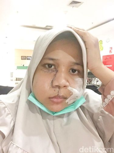 Foto Rahmi Putri Muharani Agus dan Rizkan Arif.