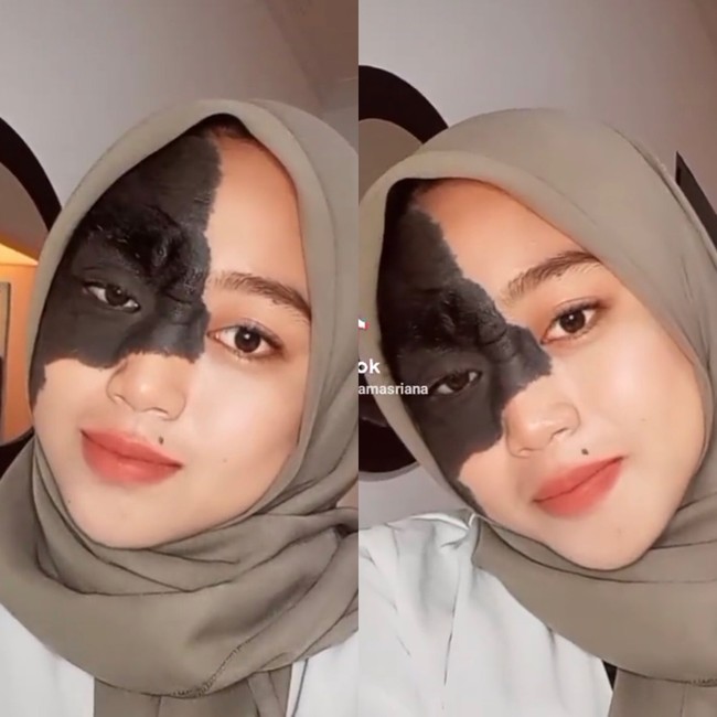 Ika dengan nada lembut menegaskan jika ia tidak ingin menghilangkan tanda lahir yang ada di wajahnya. Ika pun mengungkapkan alasannya. Aku nggak mau menghilangkannya. Karena aku sudah mensyukuri apa yang sudah diberikan oleh Allah. Kalau dulu bapak pernah berpikir untuk menghilangkannya sih. Tapi akhirnya kakek aku menghalanginya karena lebih baik disyukuri saja, ucapnya panjang lebar. Foto: Dok.Instagram @ikamasriana.