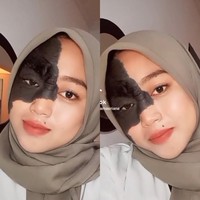 Ika dengan nada lembut menegaskan jika ia tidak ingin menghilangkan tanda lahir yang ada di wajahnya. Ika pun mengungkapkan alasannya. Aku nggak mau menghilangkannya. Karena aku sudah mensyukuri apa yang sudah diberikan oleh Allah. Kalau dulu bapak pernah berpikir untuk menghilangkannya sih. Tapi akhirnya kakek aku menghalanginya karena lebih baik disyukuri saja, ucapnya panjang lebar. Foto: Dok.Instagram @ikamasriana.