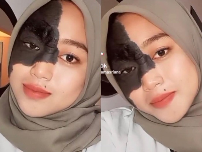 Foto Ika Masriana yang memiliki tanda lahir. Foto: Dok.Instagram @ikamasriana. Foto Ika Masriana yang memiliki tanda lahir. Foto: Dok.Instagram @ikamasriana.