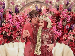 Kecantikan Lesti Kejora Dicibir, Rizky Billar Beri Jawaban Menohok