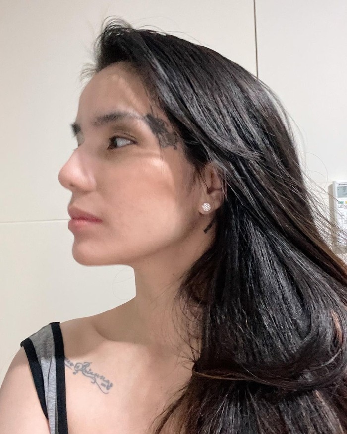 Sheila Marcia Hapus Tato