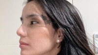 Sheila Marcia sedang berusaha menghapus tato di tubuhnya. Foto: Instagram @itssheilamj