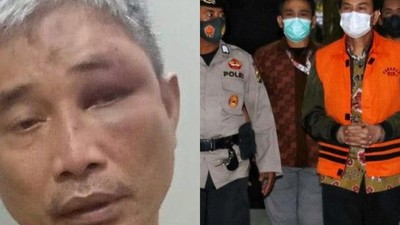 Foto Pekan Ini: Azis Syamsuddin Diborgol-Kace Lebam Dianiaya Napoleon