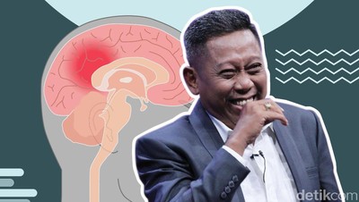 Sederet Gejala Perdarahan Otak, Kondisi yang Dialami Tukul Arwana