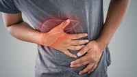 Sering Dikira Masuk Angin Biasa, Waspadai 5 Gejala Awal Penyakit Liver Ini