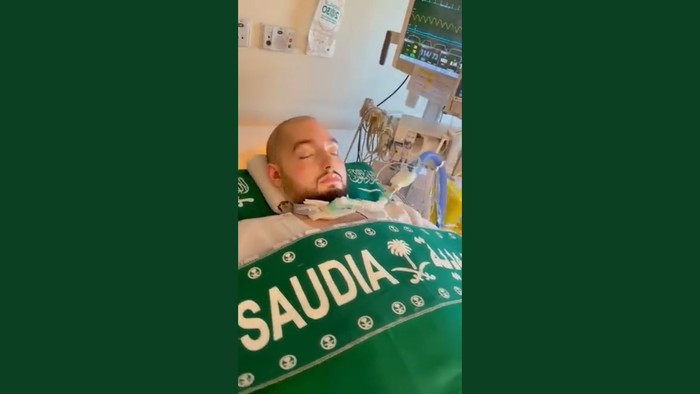 Pangeran Arab Saudi koma