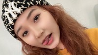 Denise dari Secret Number tidak akan berpartisipasi dalam aktivitas Secret Number karena konsultasi koordinasi kontrak dengan perusahaan, kata manajemen. (Foto: dok. Instagram @secretnumber.official) 