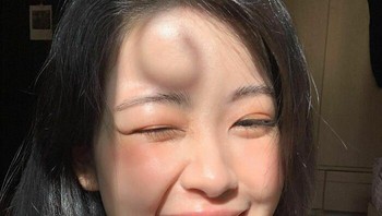 Bayangan rambut di dahi terlihat seperti benjolan, Foto: Bored Panda
