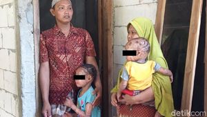 Kulit Pecah-Bersisik Sekujur Tubuh, Dua Bocah di Boyolali Idap Kelainan Langka