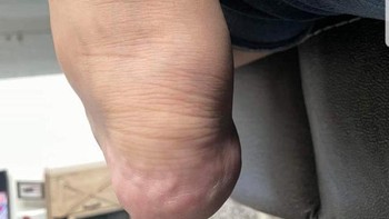 Hayo lihat apa? Ini adalah kaki kanan ketika dinaikan ke paha kiri.   Foto: Reddit