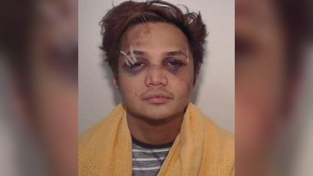 Korban Reynhard Sinaga dalam kasus 'pemerkosaan terbesar' di Inggris angkat bicara: 'Untuk bisa bicara bahwa saya telah diperkosa adalah hal sulit' Korban Reynhard Sinaga dalam kasus 'pemerkosaan terbesar' di Inggris angkat bicara: 'Untuk bisa bicara bahwa saya telah diperkosa adalah hal sulit'
