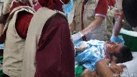 Begini salah satu reaksi anak-anak yang mengikuti sunat massal di RSPAL dr Ramelan Surabaya.