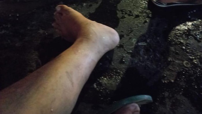 Viral Cerita Pedagang Jadi Korban Tabrak Lari Pajero di PIK Viral Cerita Pedagang Jadi Korban Tabrak Lari Pajero di PIK