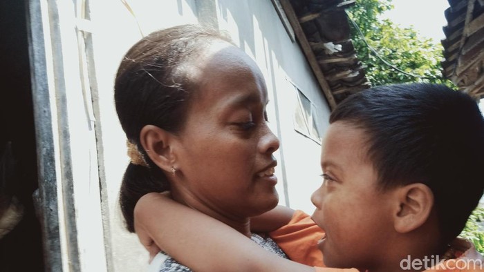 Umiyatun (32) dan anaknya Rangga Dimas Iskandar (6) yang kini tak bisa melihat.