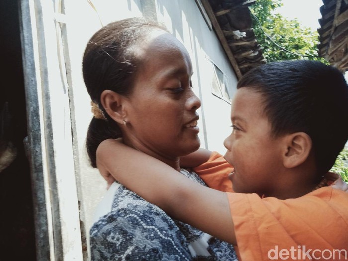 Umiyatun (32) dan anaknya Rangga Dimas Iskandar (6) yang kini tak bisa melihat.