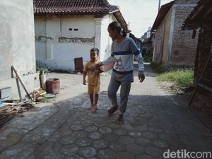 Tolong! Bocah di Klaten Ini Mendadak Buta, Mau Operasi Terbentur Biaya
