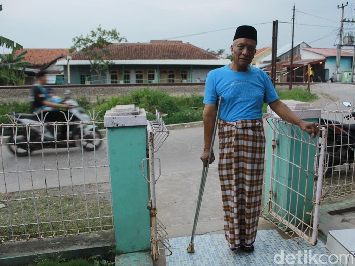 Kisah Endun Rukmana yang kehilangan satu kakinya gegara terlindas kereta