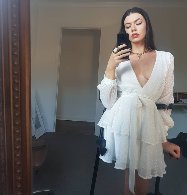 Cherie didiagnosa penyakitnya di usia enam tahun. Ketika itu, dokter sudah mengatakan semua kakinya harus diamputasi. Karena kondisi tersebut, ia tentu pernah merasa minder. Foto: Instagram @cherie.louise