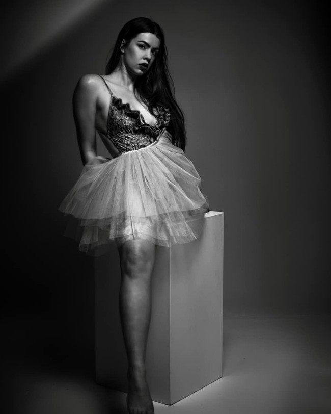 Saat kecil, aku tidak percaya aku bisa dapat pekerjaan, jatuh cinta, punya keluarga atau hal-hal seperti itu karena aku tidak kenal orang diamputasi (yang melakukannya). Ada banyak malam yang dihabiskan menangisi foto-foto diriku sebelum diamputasi, bertanya mengapa ini terjadi padaku, berharap aku akan bangun suatu hari dan punya dua kaki lagi, kata Cherie. Foto: Instagram @cherie.louise