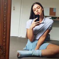 Dulu ia pun sering menghindari bersosialisasi tapi pikirannya terbuka ketika mulai berbagi foto di media sosial dan bertemu orang-orang lain yang kehilangan kaki atau punya kekurangan. Foto: Instagram @cherie.louise