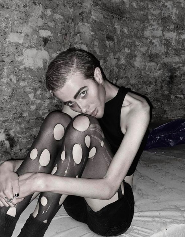 Penampakannya ini tentu saja membuat banyak pihak khawatir. Tubuhnya tampak begitu tipis, bahkan tinggal tulang. Foto: dok. Instagram/@joeyturnerrr